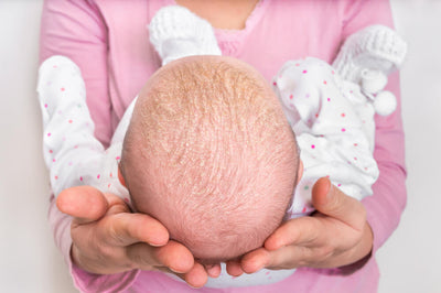How to Get Rid of Cradle Cap: Simple Home Remedies
